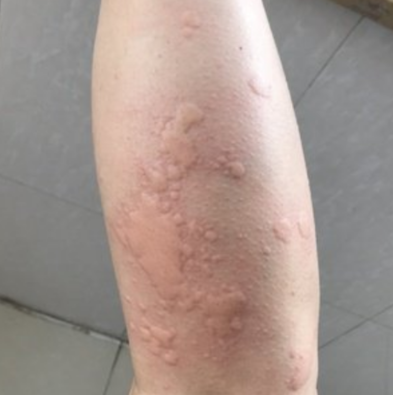 在线挂号缓解皮肤病困扰 —— 破解快速就医难题